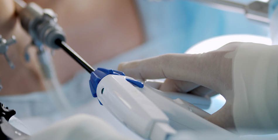 A close-up of a surgeon’s gloved hand holding a laparoscopic surgical instrument during a minimally invasive procedure.