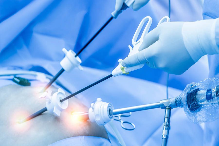 Surgeons perform a minimally invasive laparoscopic procedure using specialized instruments inserted through small incisions in the patient’s abdomen.