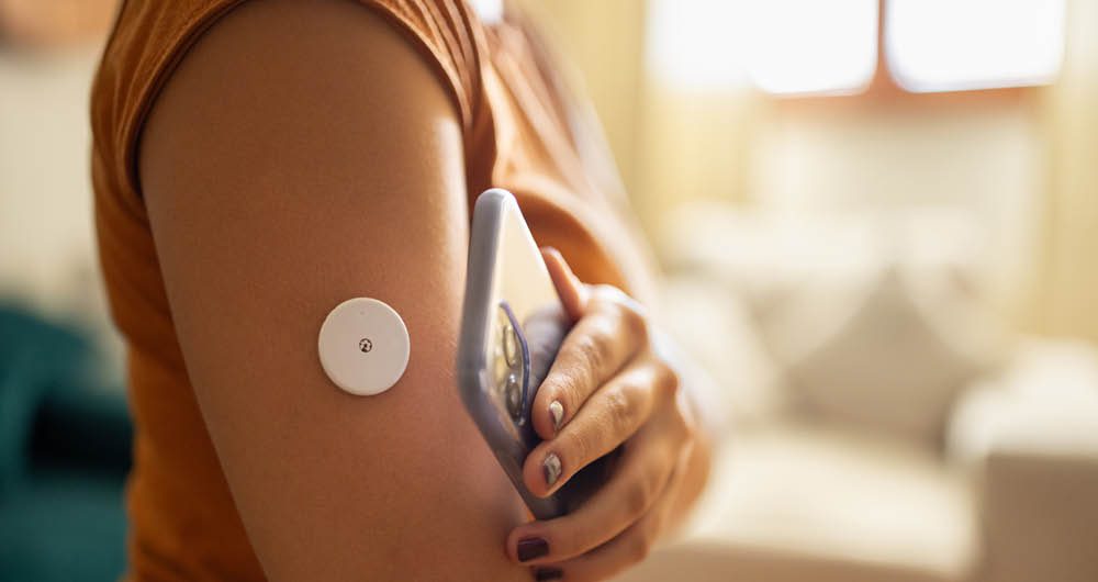 A person holds a smartphone near their upper arm, which has a circular glucose monitor attached to the skin.