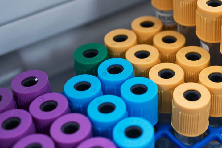 A close-up of multiple blood sample tubes with purple, green, blue, and yellow caps organized in rows.