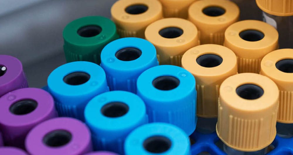 Close-up of laboratory test tubes with purple, green, blue, and yellow caps arranged together in a storage rack.