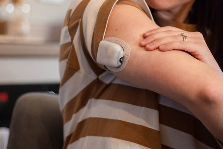 Person wearing a striped shirt shows an electronic medical device attached to their upper arm, likely a health monitor or insulin patch.