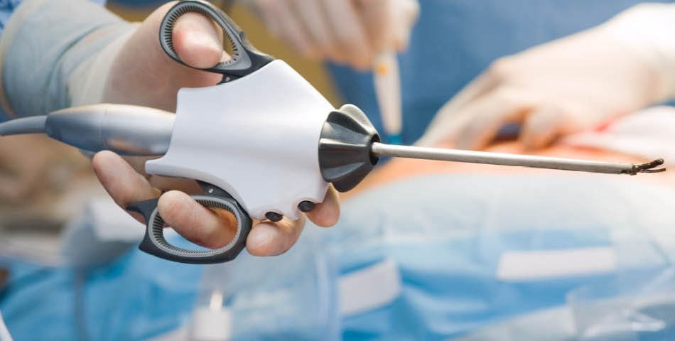 Close-up of a surgeon’s hand holding a laparoscopic surgical instrument during a medical procedure, with another gloved hand visible in the background.
